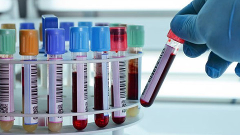 Kanada'da bilim insanları, kanı dönüştüren teknik geliştirdi