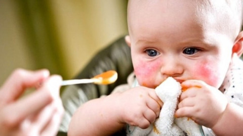 Bebeklerde ve çocuklarda gıda alerjisi nasıl anlaşılır?