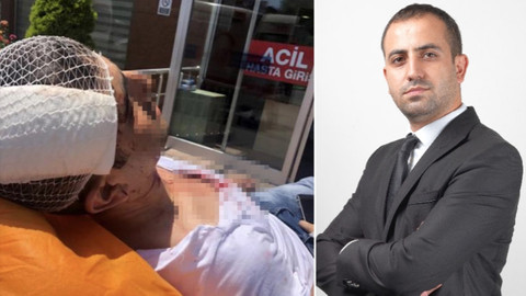 Akit Haber Müdürü Murat Alan'a saldırı