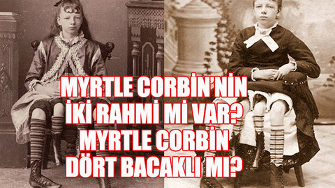 Myrtle Corbin’nin iki rahmi mi var? Myrtle Corbin dört bacaklı mı?