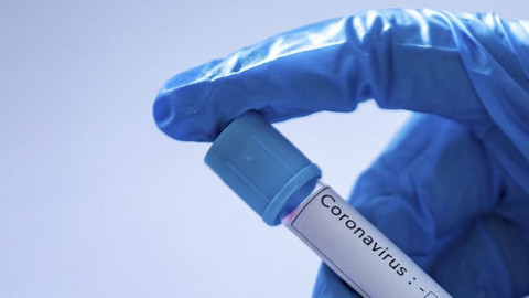 Koronavirüste vaka tanımı değişti: Sadece öksürüğü olana da test yapılacak