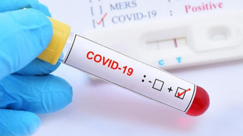 Sağlık Bakanlığı duyurdu! Koronavirüs tedavisiyle ilgili yeni karar