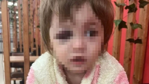 Baba ve kızını darbeden şüphelinin ifadesi ortaya çıktı!  "Kucağındaki çocuğu fark etmemişim"