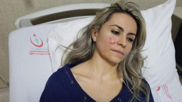 Asker çürük raporu vermeyen kadın doktoru darp etti