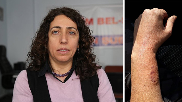 HDP'li vekil polisin kolunu ısırdı!