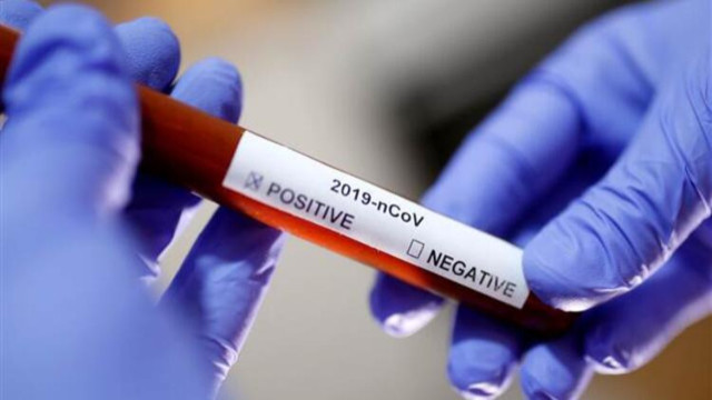 Koronavirüs salgını... Slovakya'da OHAL ilan edildi