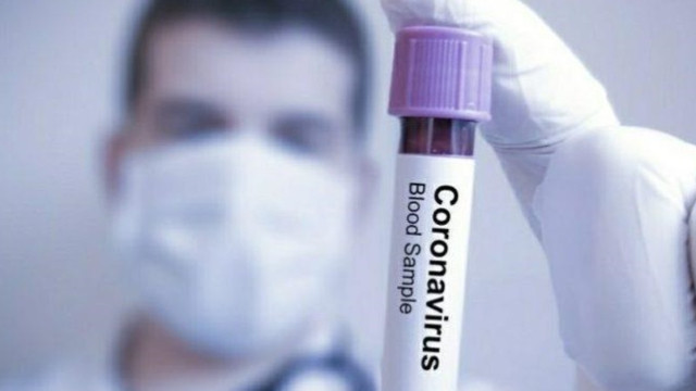 Türkiye'de hangi hastanelerde koronavirüs testi yapılıyor?
