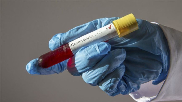 Türkiye'de son 24 saatte koronavirüs bilançosu