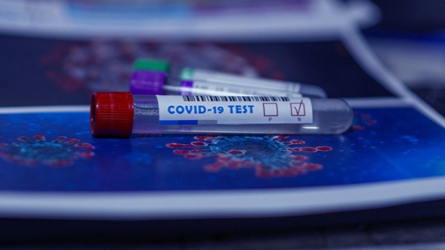 Türkiye'de koronavirüs salgınında son rakamlar