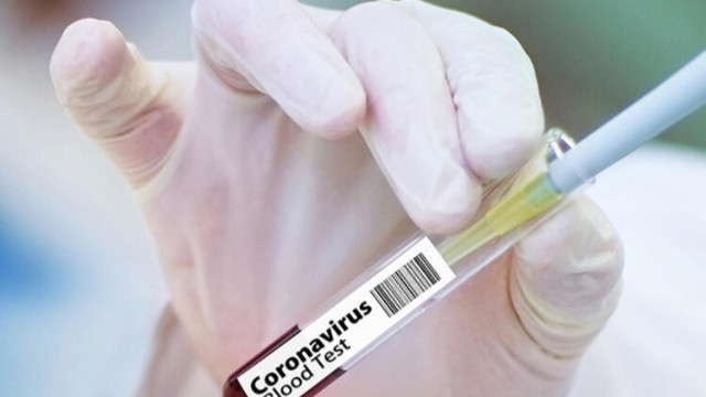 Koronavirüs aşısında önemli gelişme! Tarih verdiler