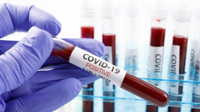 21 Kasım 2020 koronavirüs rakamları açıklandı