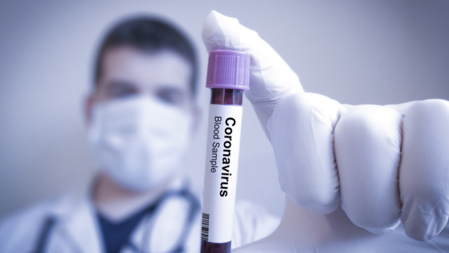 Son 24 saatte 202 kişi koronavirüs nedeniyle vefat etti