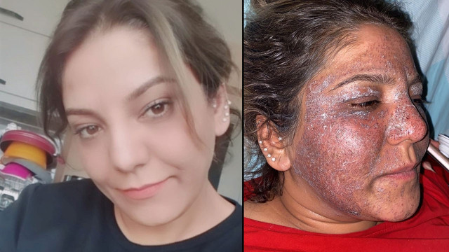 'Yüzün bebek gibi olacak' dediler bu hale getirdiler