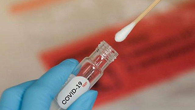 22 Mart koronavirüs tablosu açıklandı