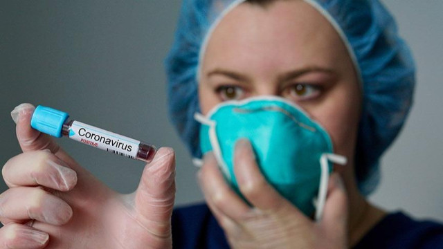 Türkiye'de son 24 saatte koronavirüsten 157 kişi hayatını kaybetti