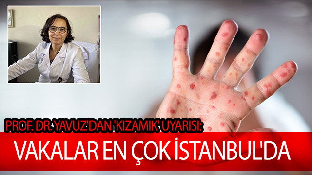 Prof. Dr. Yavuz'dan 'kızamık' uyarısı: Vakalar en çok İstanbul'da