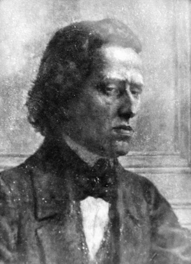 Chopin'in ölüm nedeni, saklanan kalbi sayesinde çözüldü - Sayfa 5