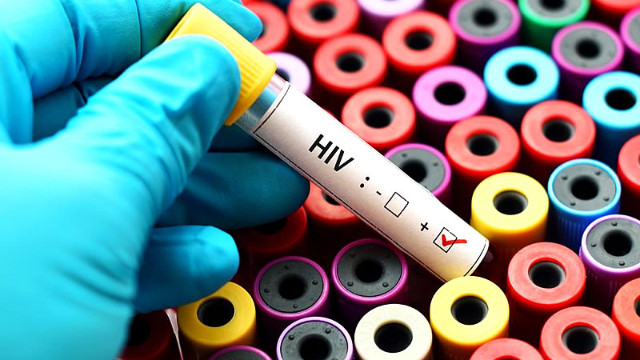 HIV virüsü bulaştıktan sonra vücutta ne tür değişiklikler olur?