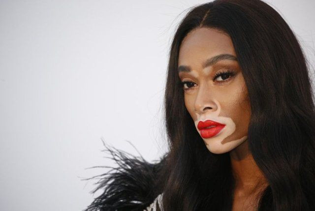 Winnie Harlow karantinadan çıktı - Sayfa 5