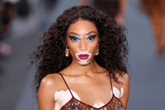 Winnie Harlow karantinadan çıktı - Sayfa 6