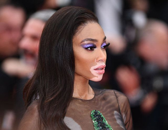 Winnie Harlow karantinadan çıktı - Sayfa 9