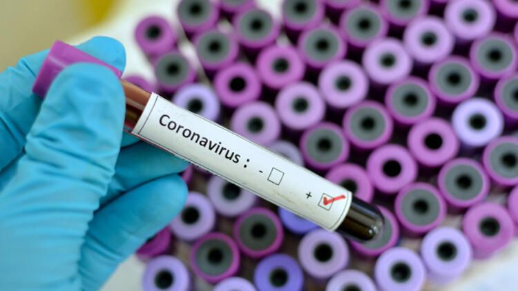CDC resmi duyuruyu yaptı! Koronavirüse 3 yeni belirti eklendi - Sayfa 2