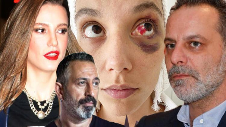 Serenay Sarıkaya'ya Deniz Bulutsuz sorusu! - Sayfa 2