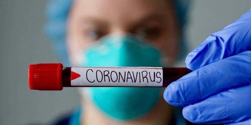Dünya geneli koronavirüs bilançosu! 1 milyon 309 bin 703 kişi yaşamını yitirdi - Sayfa 2