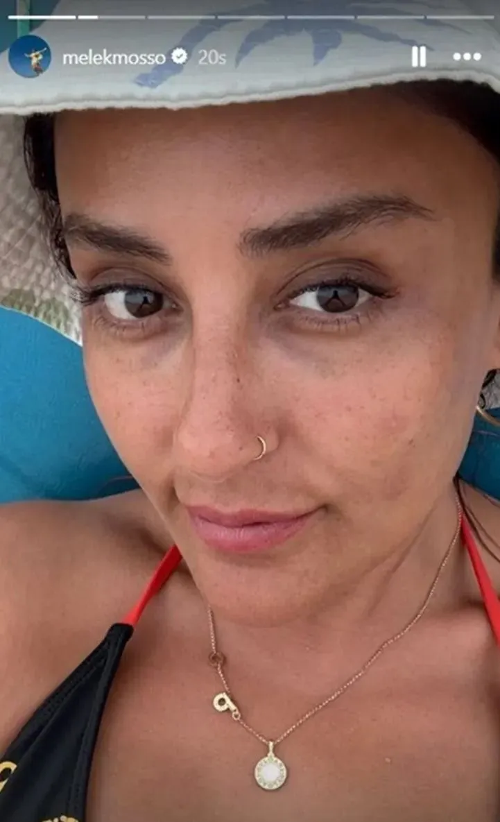 Melek Mosso isyan etti! Makyajsız halini yerden yere vurdular