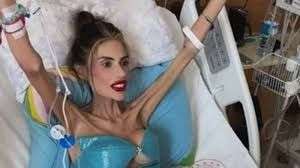 Nihal Candan hayatını kaybetti! 23 kiloya kadar düşmüştü - Sayfa 6