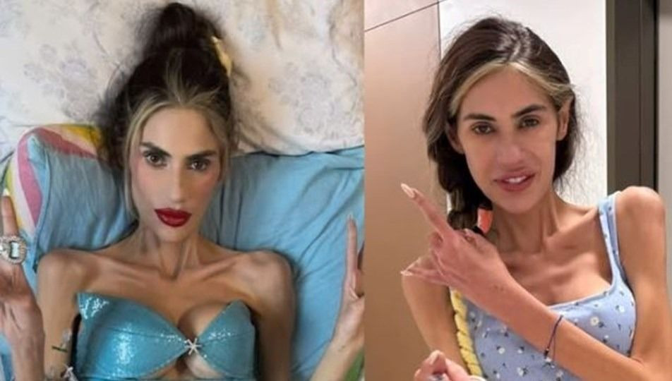 Nihal Candan hayatını kaybetti! 23 kiloya kadar düşmüştü - Sayfa 7