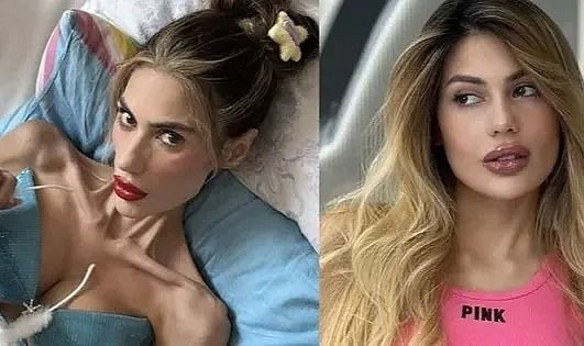 Nihal Candan hayatını kaybetti! 23 kiloya kadar düşmüştü - Sayfa 11